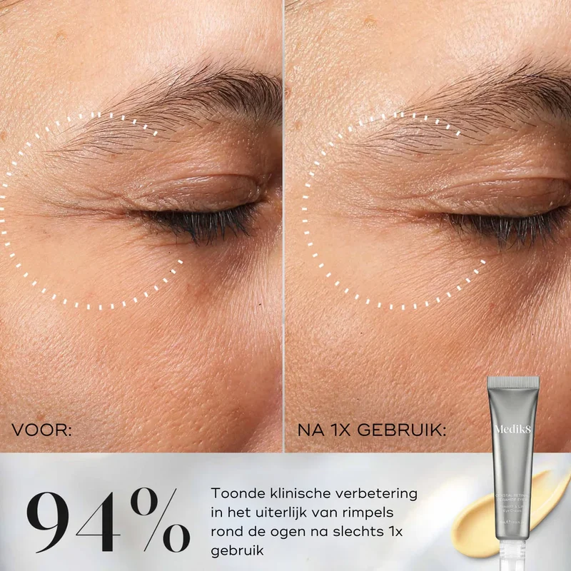 Crystal Retinal Ceramide Eye 10