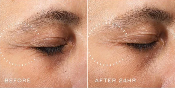 Crystal Retinal Ceramide Eye 6