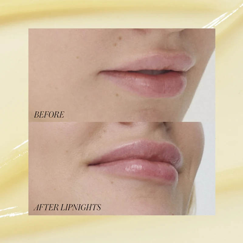 Liplights - Overnight Lip Mask