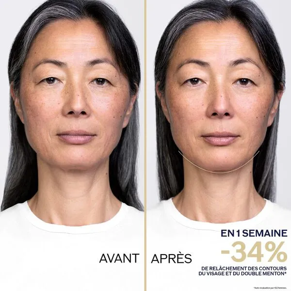 Shiseido Concentré Nuit Eclat Contours Redéfinis