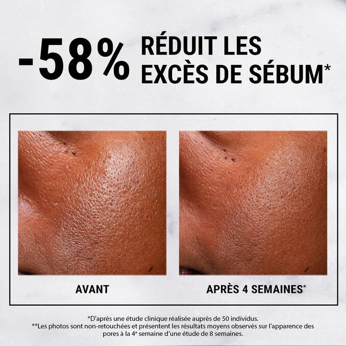 Kiehl’s - Ultra Pure High-Potency Niacinamide