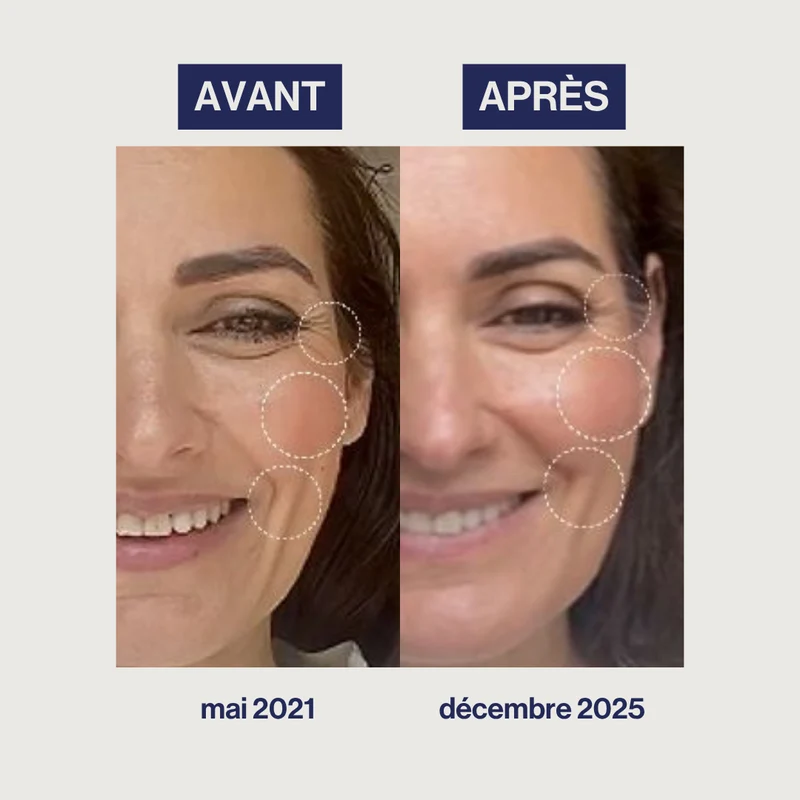 Augmented Collagen - Rides, Fermeté, Élasticité