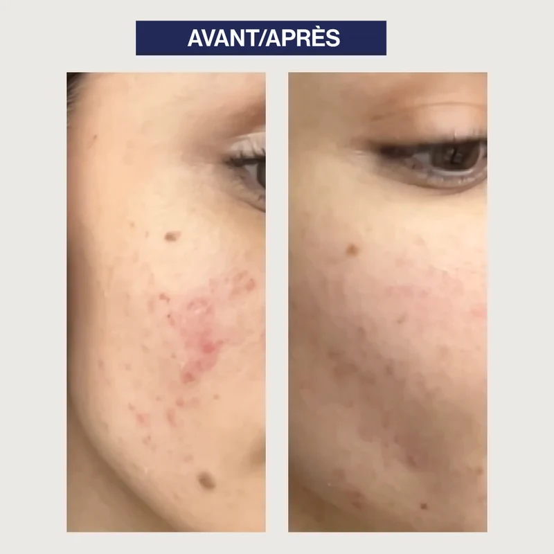Gel Nettoyant Exfoliant Probiotiques