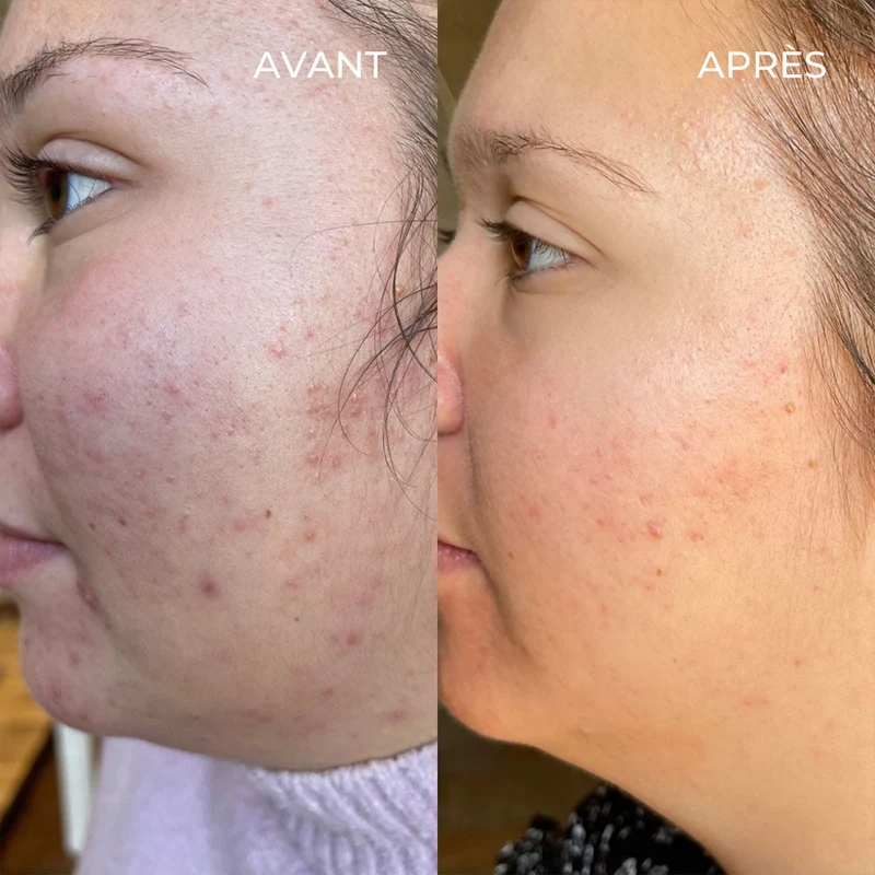 Le sérum anti-imperfections